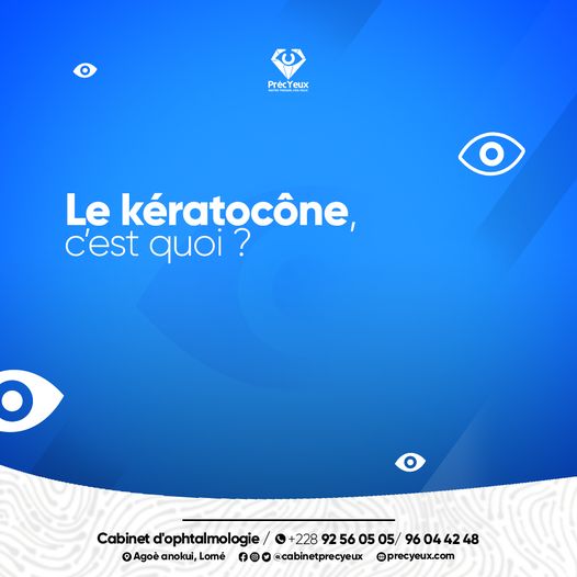 LE KERATOCONE